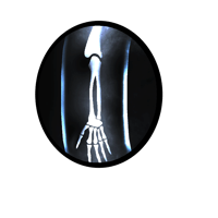 Badlion Product: Xray Shield